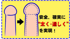 包茎専門の埼玉大宮中央クリニック 亀頭増大,陰茎増大