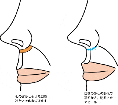 口の整形 大宮中央クリニック